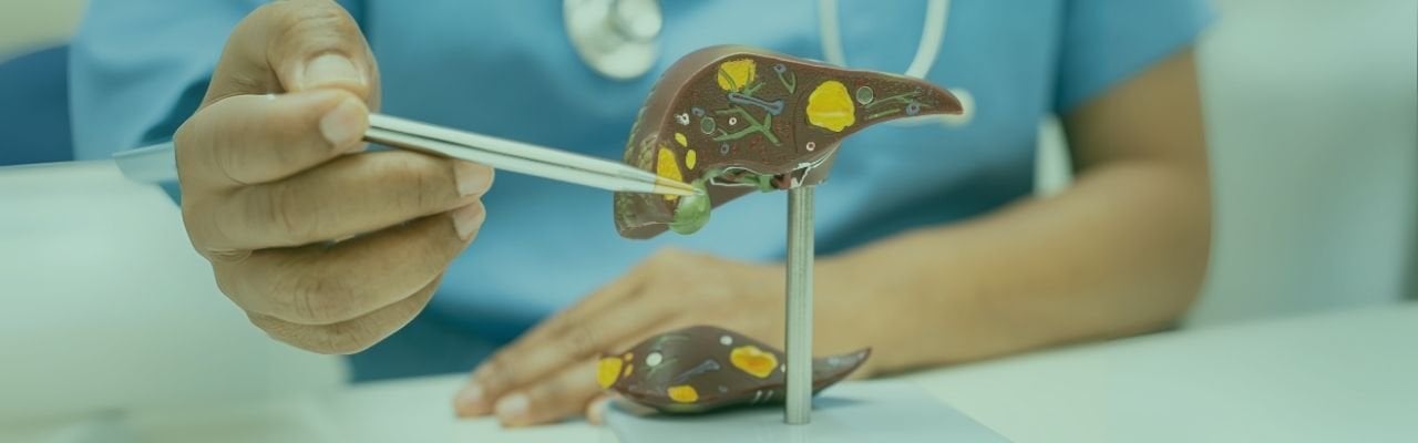 Karaciğer Yağlanmasına Karşı Mikrobiyal Bir Kalkan: Bütirat ve NAFLD